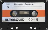 Compact Cassette Ultrasound 45 Type I Normal Hong Kong