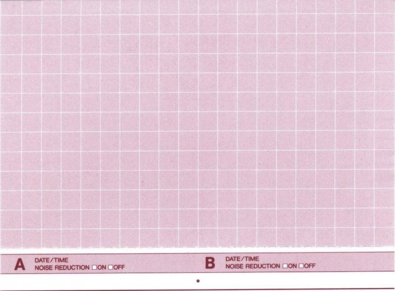 Compact Cassette TDK AR 90 "AR-90N" Type I Normal 1988 Australia, Europe